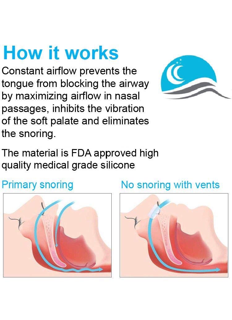 Nostril Opener by Snore Bastion -12 Nasal Dilators for Sleeping - Soft Silicone Nose Breathing Inserts - Nasal Cones - Nose Plugs for Snoring - Snore Silencer Sinus Vents - Nose Vents