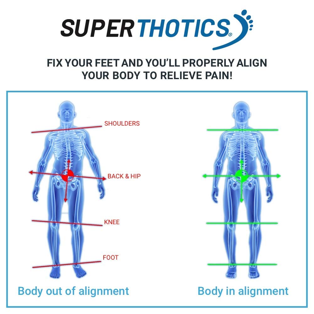 Superthotics by WalkFit Customizable Orthotic Inserts Arch Support Shoe Insoles for Men & Women Relieve Plantar Fasciitis, Foot, Hip, Knee & Back Pain. Restore Balance, Stability & Comfort